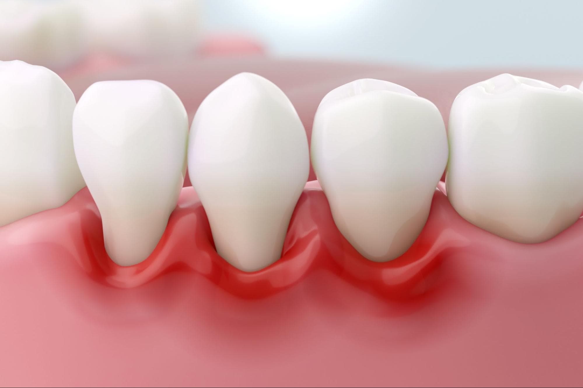 Advanced Periodontics of New Jersey