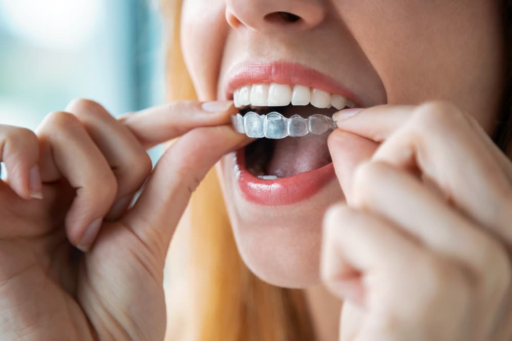 Advanced Smile Care