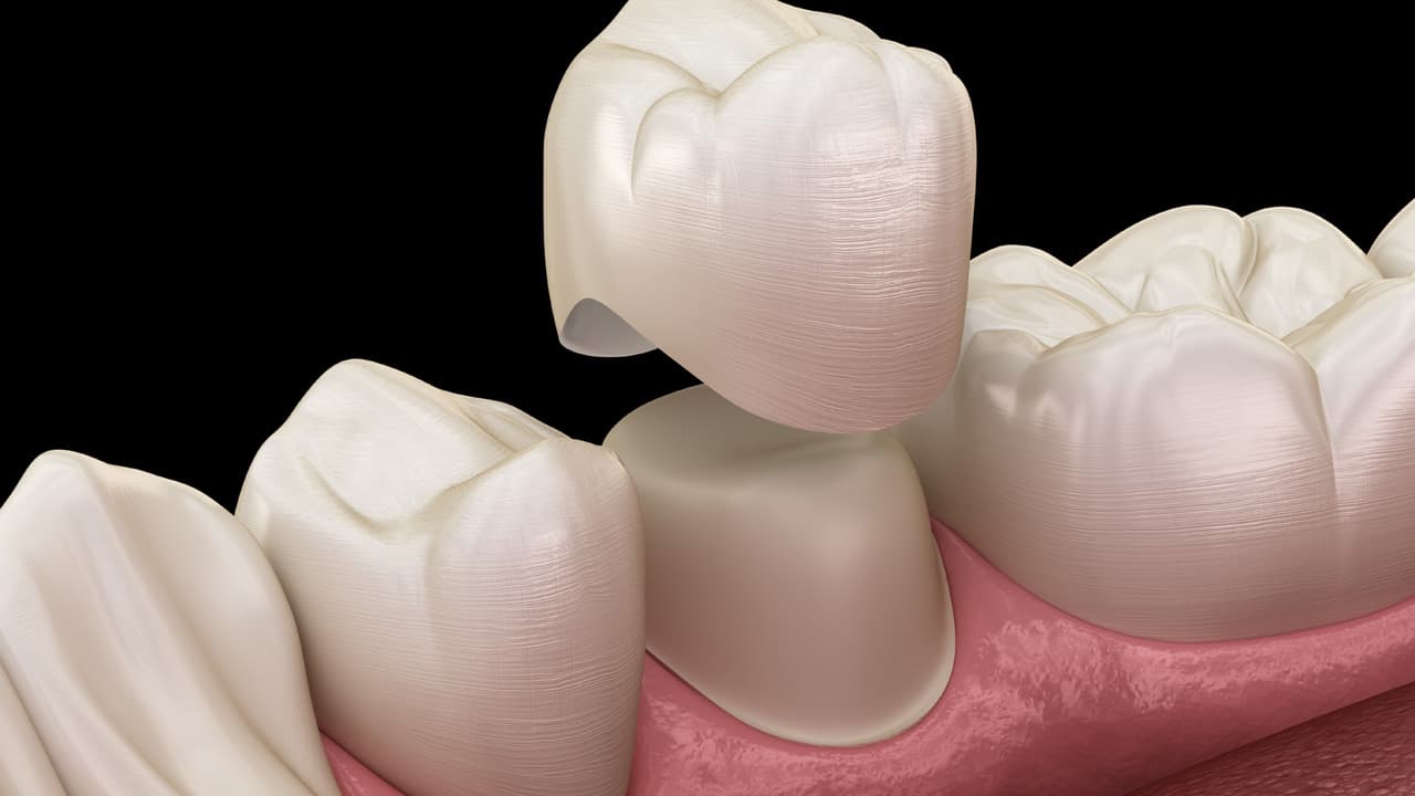 Advanced Smile Care