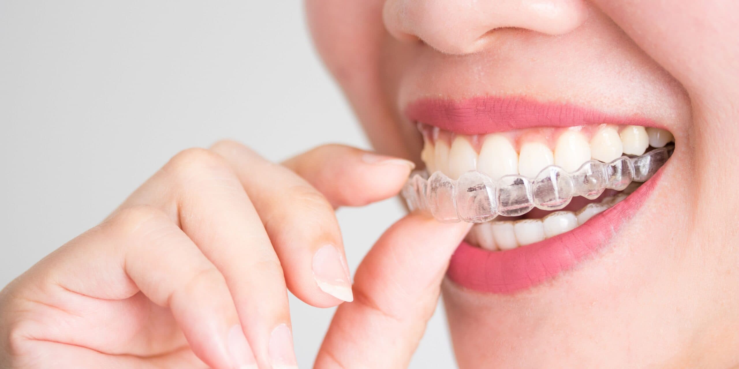 Bagoff Dental Arts - General Family Dentist & Dental Implant Specialist
