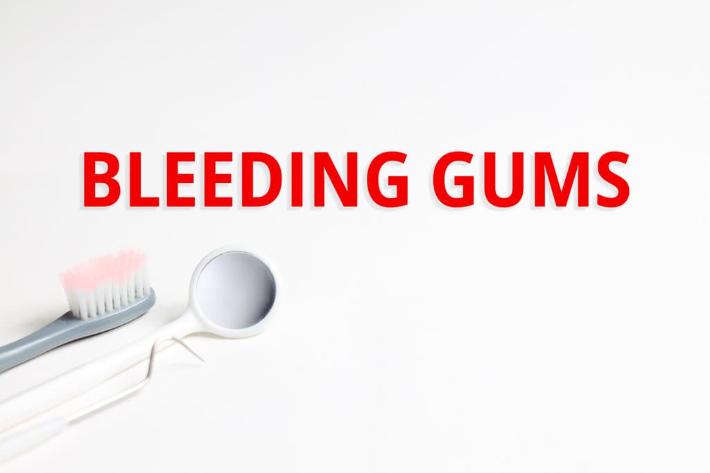 Why Do My Gums Bleed When I Brush My Teeth
