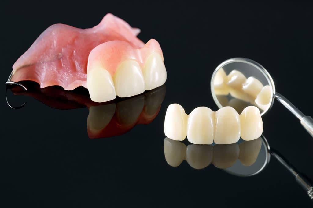 Dental prosthetic isolatic - partial denture upper side.
