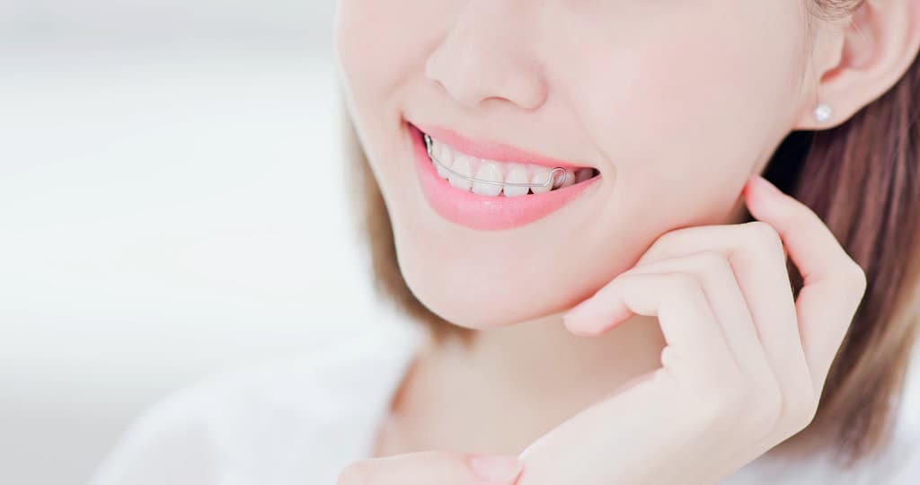 Best Way to Clean Retainers