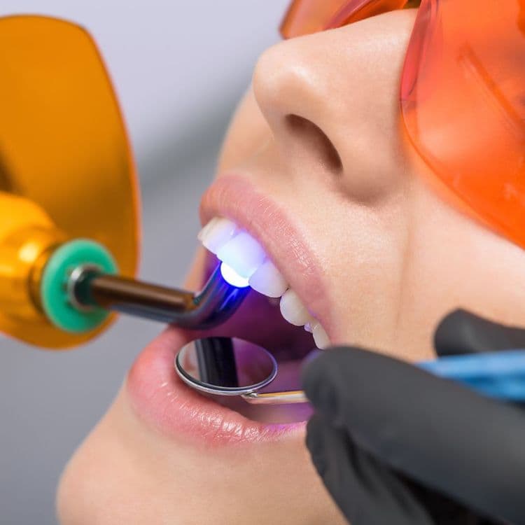 Is Professional Teeth Cleaning Worth It