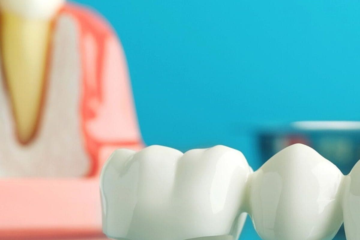 Close-up of Fake Teeth on a Glass Surface.jpg