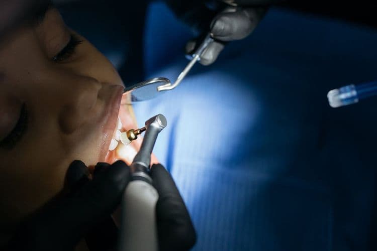 Braces Cement Removal