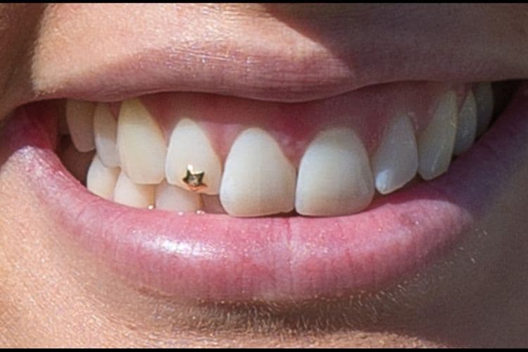 Permanent Tooth Gems