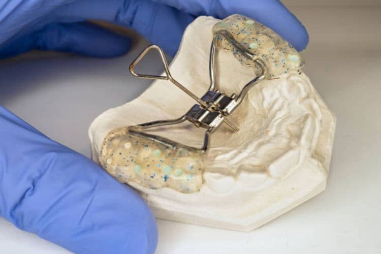 Expander for Teeth