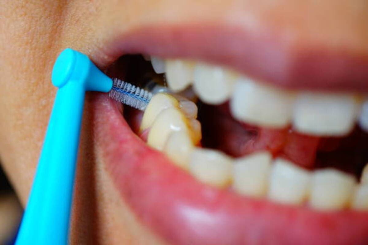 Cleaning His Teeth With An Interdental Small Brush