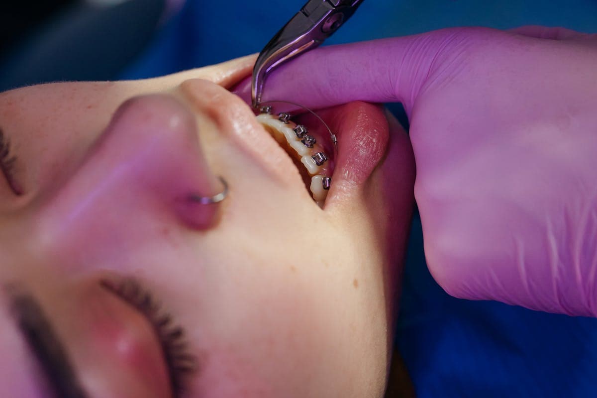 Photo of Dentist Examining Patient's Teeth