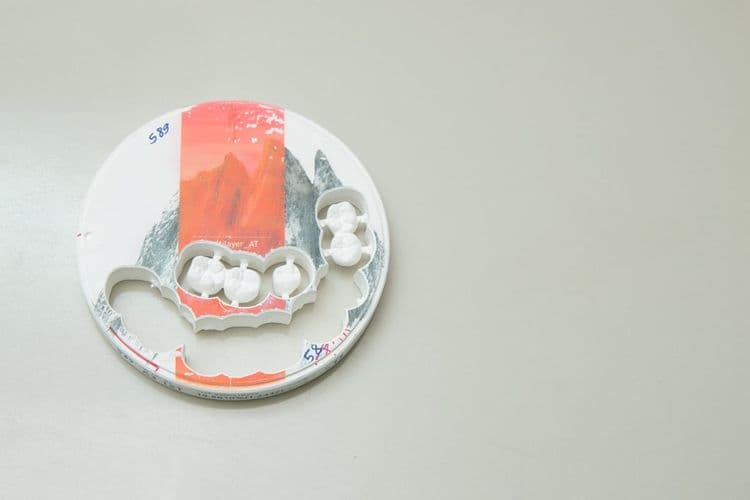 What Is a Dental Crown