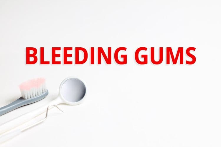 Why Do My Gums Bleed When I Brush My Teeth
