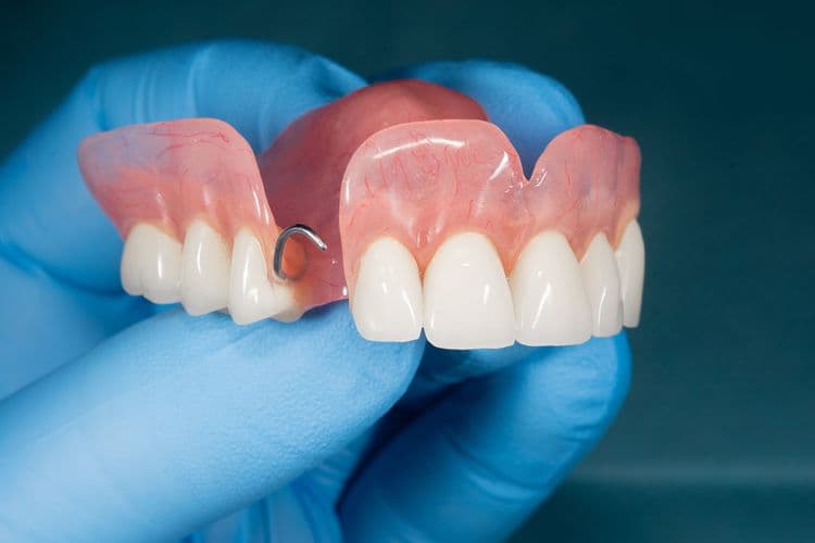 Upper Partial Dentures