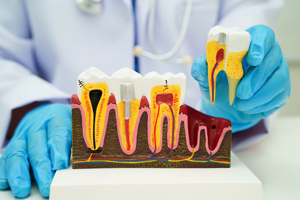 Dentist holding dental implant, artificial tooth roots into jaw, root canal of dental treatment, gum disease, teeth model for dentist.
