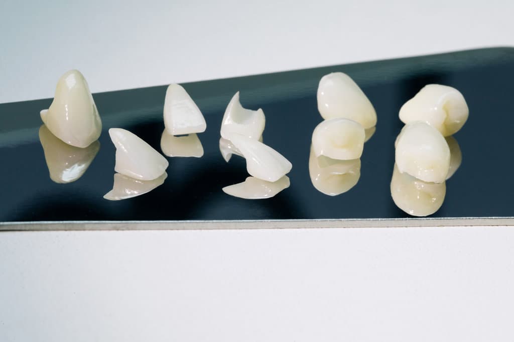 Zirconium crowns veneers. Ceramic teeth with the veneers isolated on white background