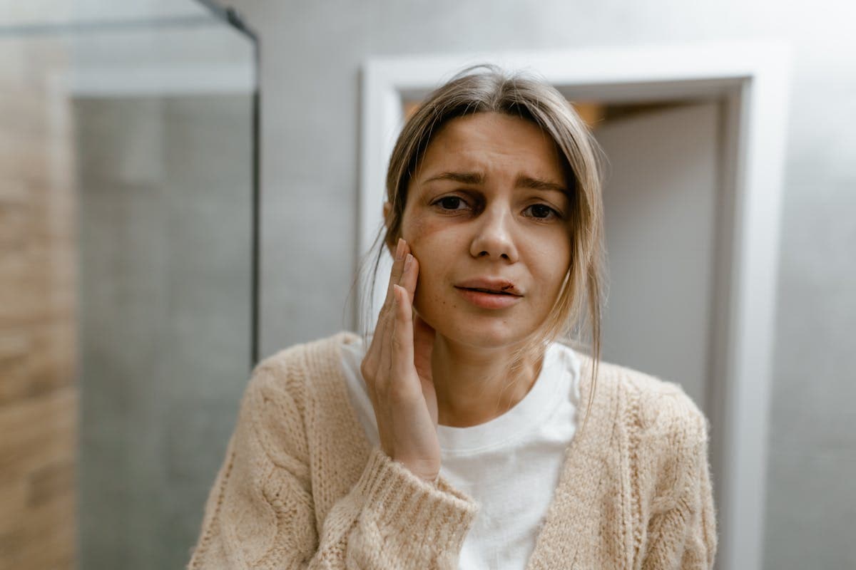 A Woman in Beige Sweater Touching her Bruised Face.jpg