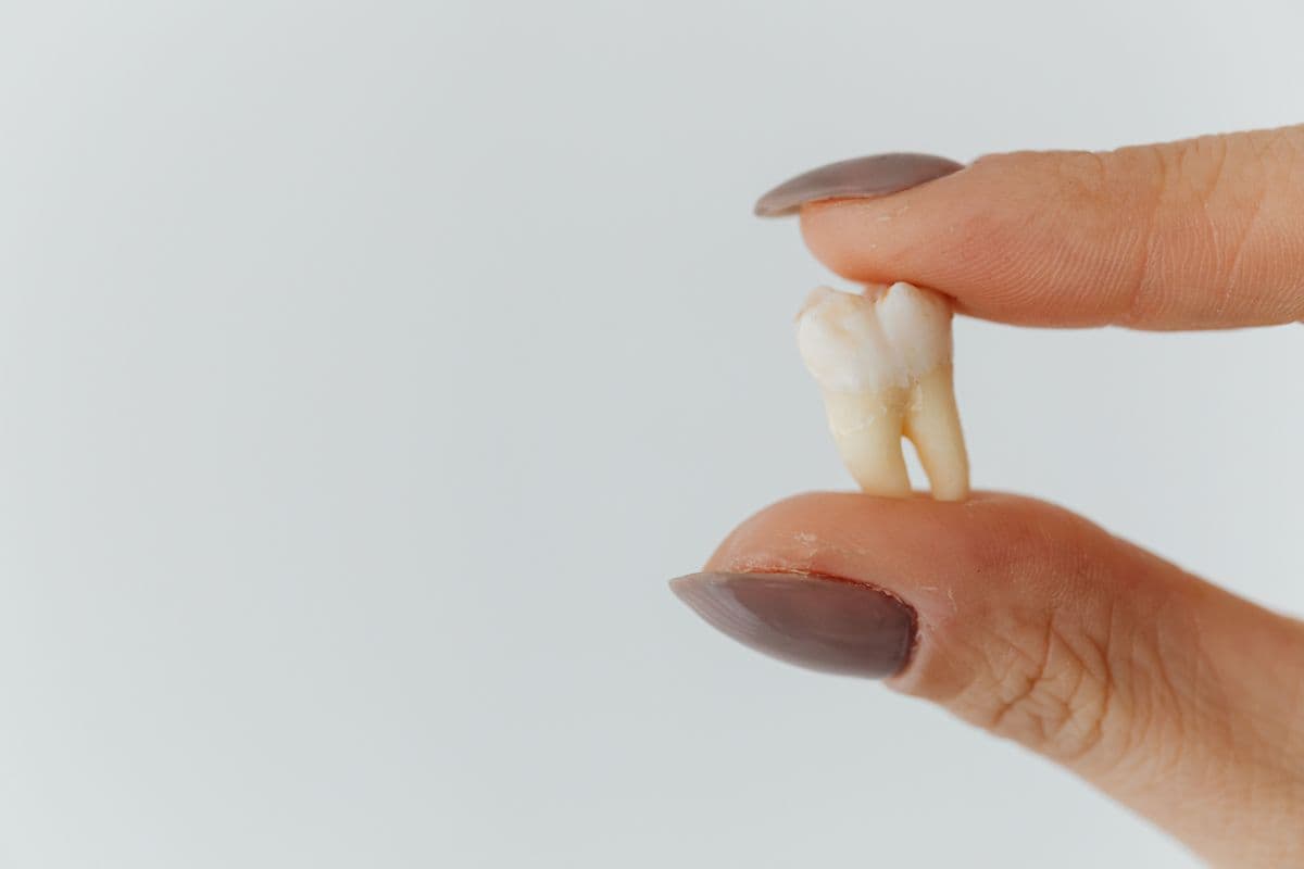 Close-up Shot of a Loose Tooth.jpg