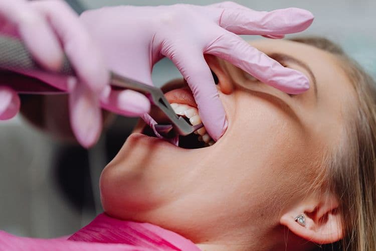 Tooth Extraction Complications Years Later